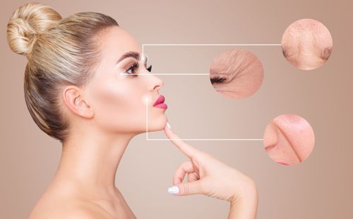 Collagen structural thread lifts